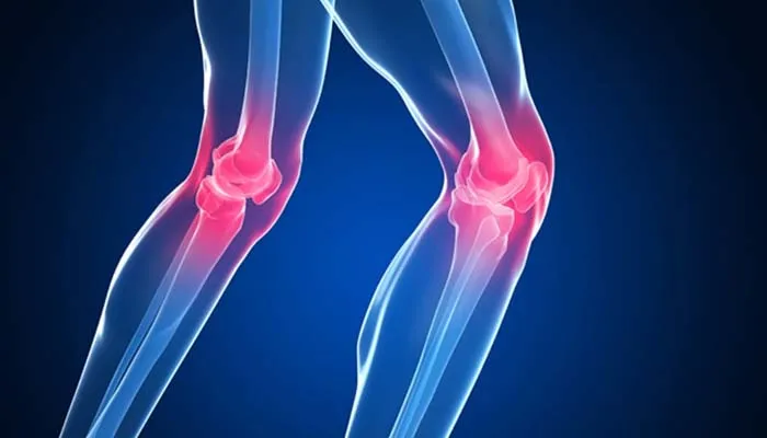 diz-kapagindaki-kireclenme-nasil-gecer